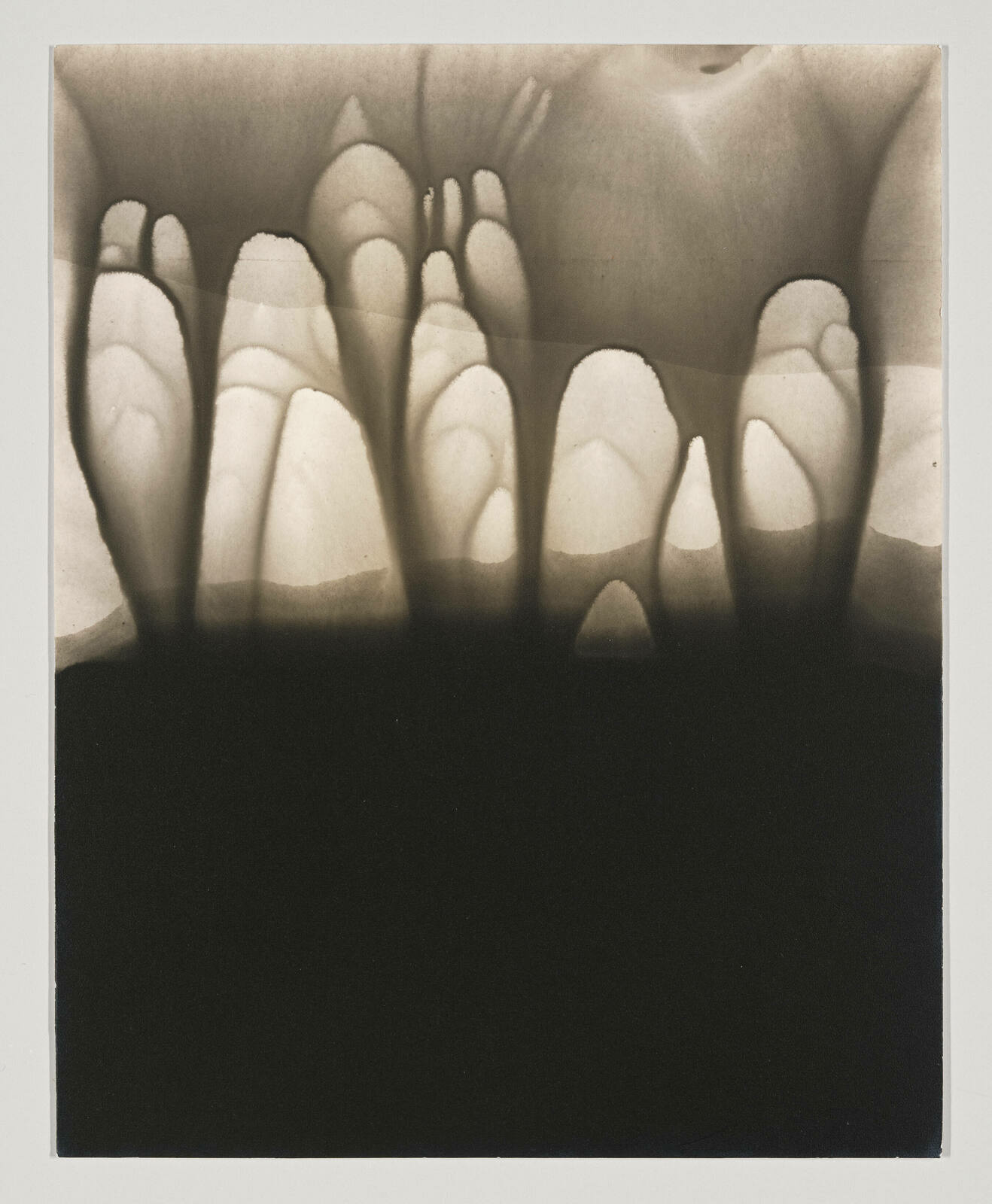 A sepia-toned X-ray image showing the bones of two feet with toes clearly visible, set against a dark background.